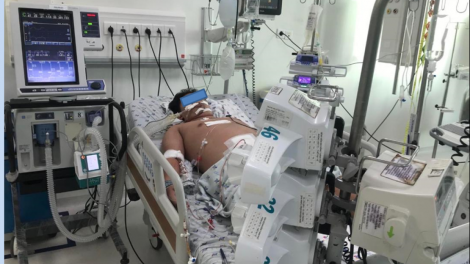 Sốt xuất huyết biến chứng nặng ở trẻ thừa cân, béo phì