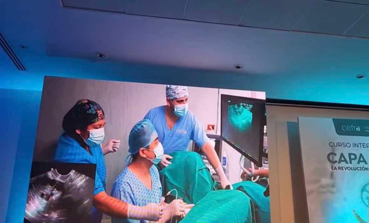 BS Lê Long Hồ trình diễn chọc hút trứng bằng kỹ thuật CAPA -IVM tại Hội thảo Y học quốc tế