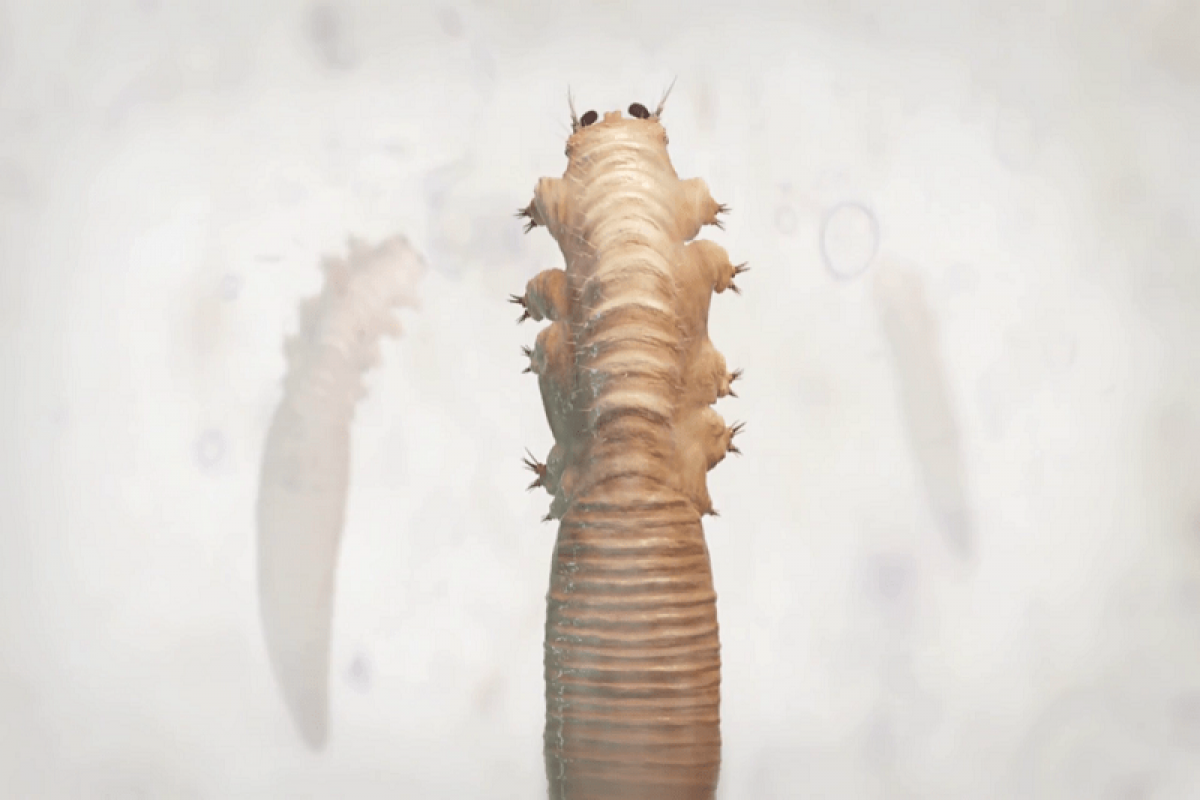 Cần cảnh giác với ký sinh trùng Demodex gây bệnh trên da. Ảnh: Internet