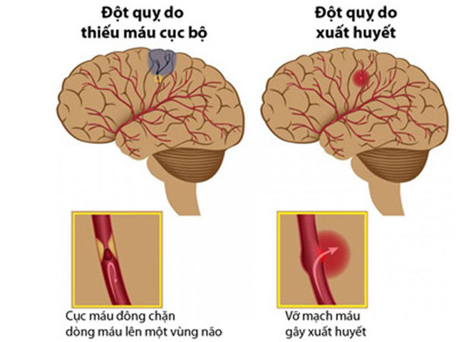image-article