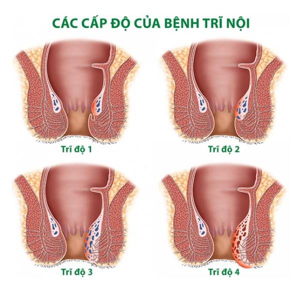image-article