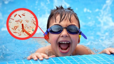 Bác sĩ hướng dẫn cách phòng tránh viêm tai khi bơi lội trong ngày hè
