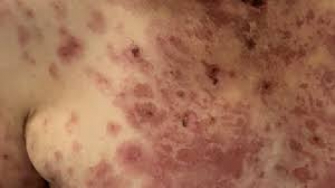 Bất thường ở da cảnh báo một số bệnh lý nguy hiểm