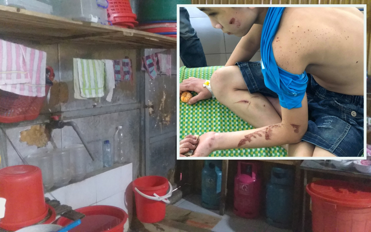 Nạn nhân trong vụ ngược đãi, tra tấn trẻ em ở quán bánh xèo tỉnh Bắc Ninh