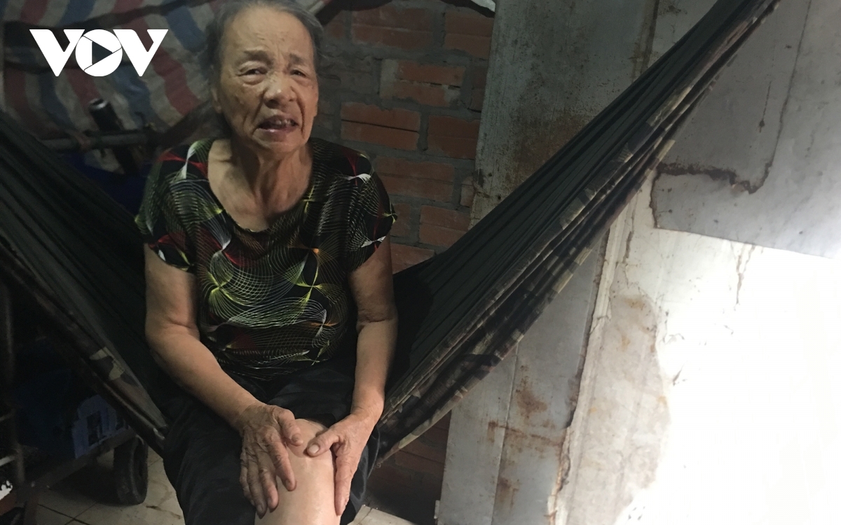 Lúc trái nắng, trở trời đôi chân bà Bình đau nhức vì di chứng của tai nạn giao thông