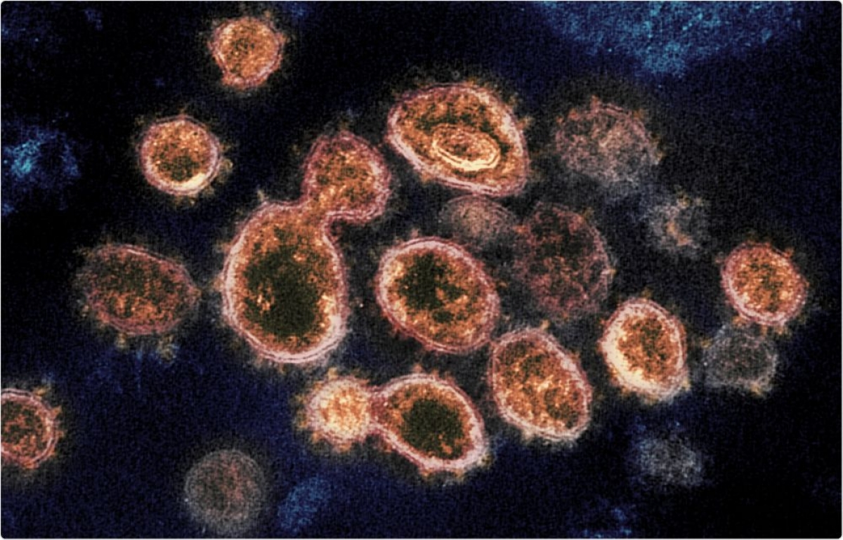 Virus corona biến chủng sẽ làm gia tăng mức độ nghiêm trọng của dịch Covid-19 (Ảnh minh họa)