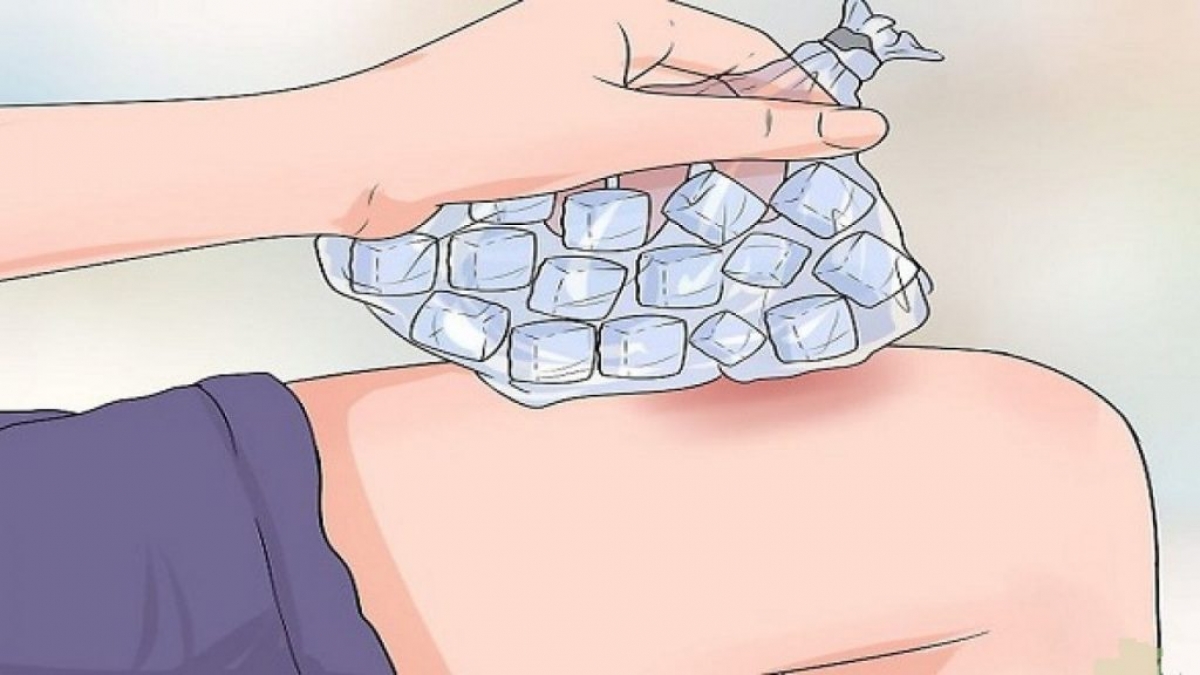 Xử trí chấn thương thể thao đúng cách giảm mức độ tổn thương