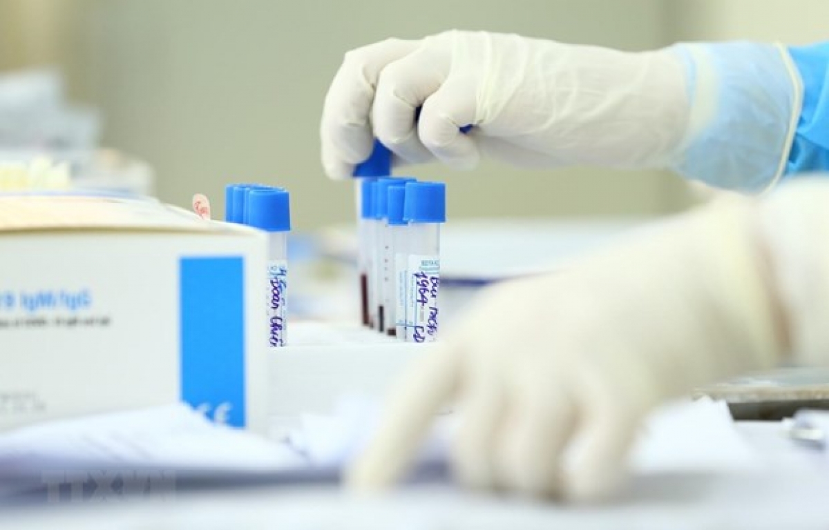 Mẫu xét nghiệm SARS COV-2