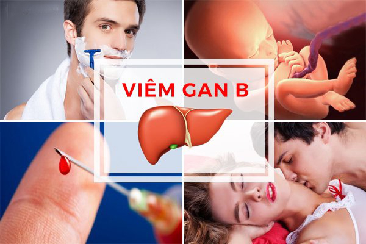 Các đường lây truyền bệnh viêm gan B