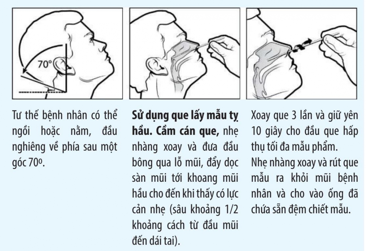 Thao tác tự lấy mẫu đường mũi