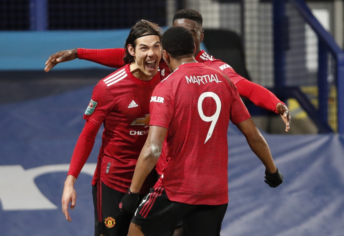 Martial đã bị chỉ trích vì... lười chạy!