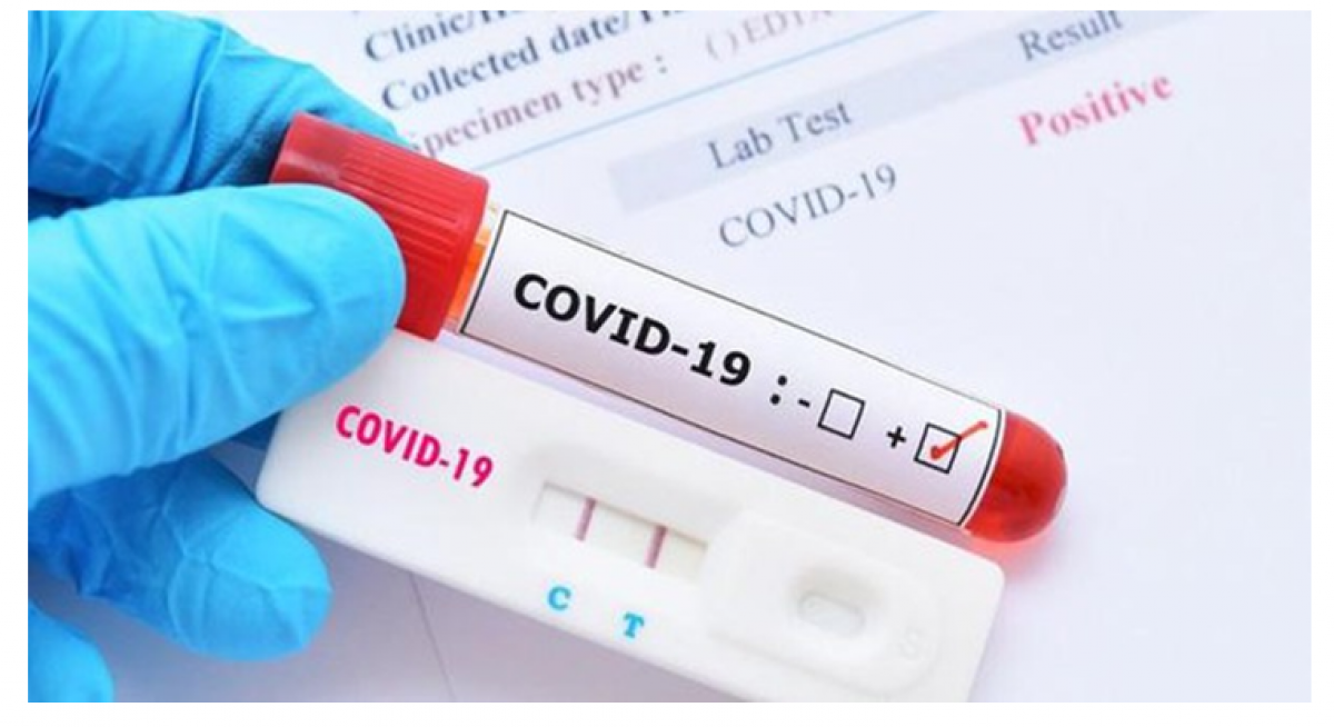 Cần cảnh giác trong việc giám sát các biến chủng của SARS CoV-2 dù bệnh này là nhóm A hay nhóm B
