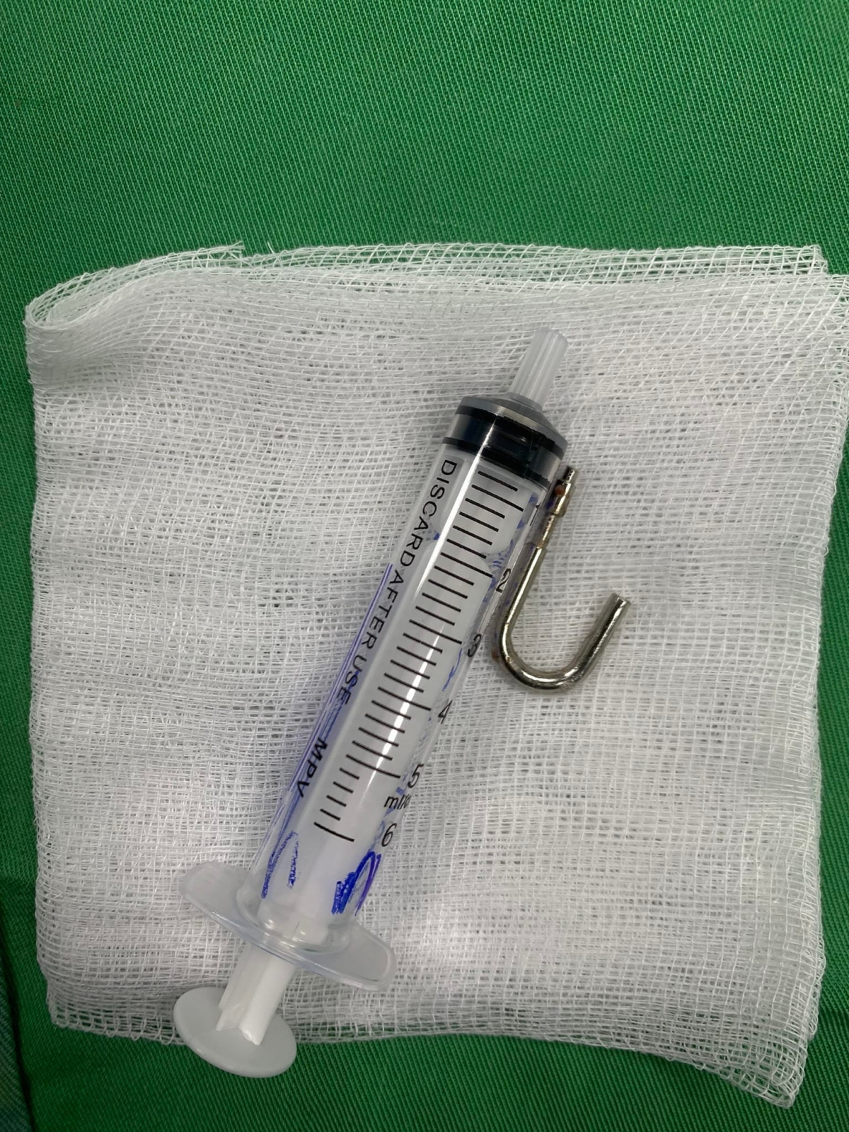 Móc khóa được lấy ra khỏi dạ dày bệnh nhân N.
