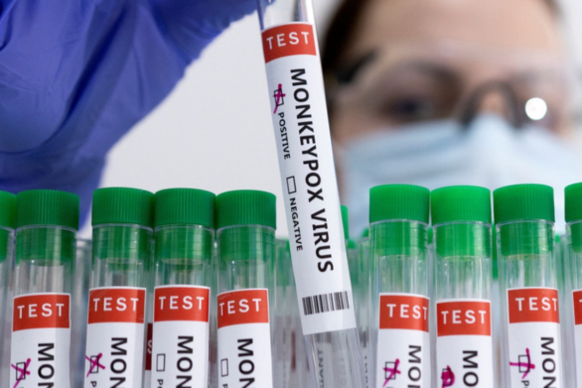 Vaccine đậu mùa khỉ đang được tiêm tại các nước Châu Âu