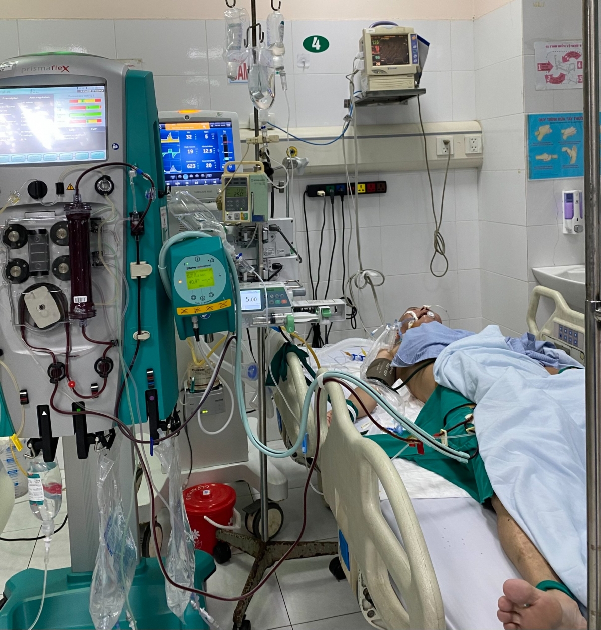 Bệnh nhân điều trị tại khoa Hồi sức - chống độc. Ảnh: Bệnh viện cung cấp