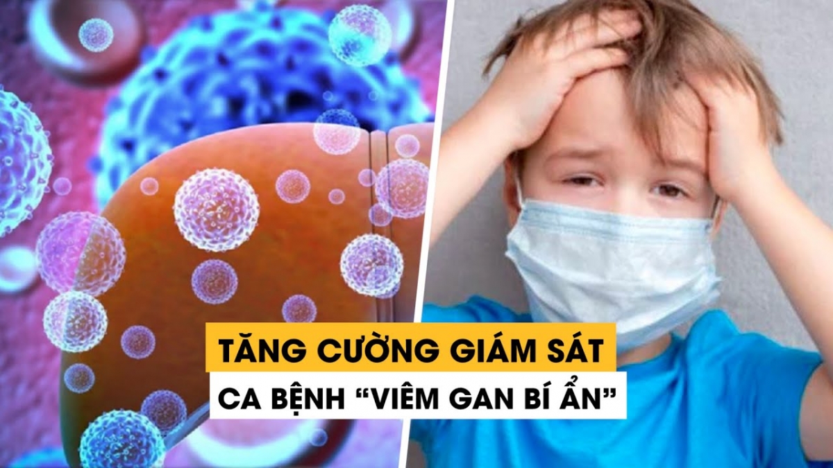 Ngành y tế đang theo dõi chặt chẽ thông tin về bệnh viêm gan cấp để có biện pháp ứng phó kịp thời