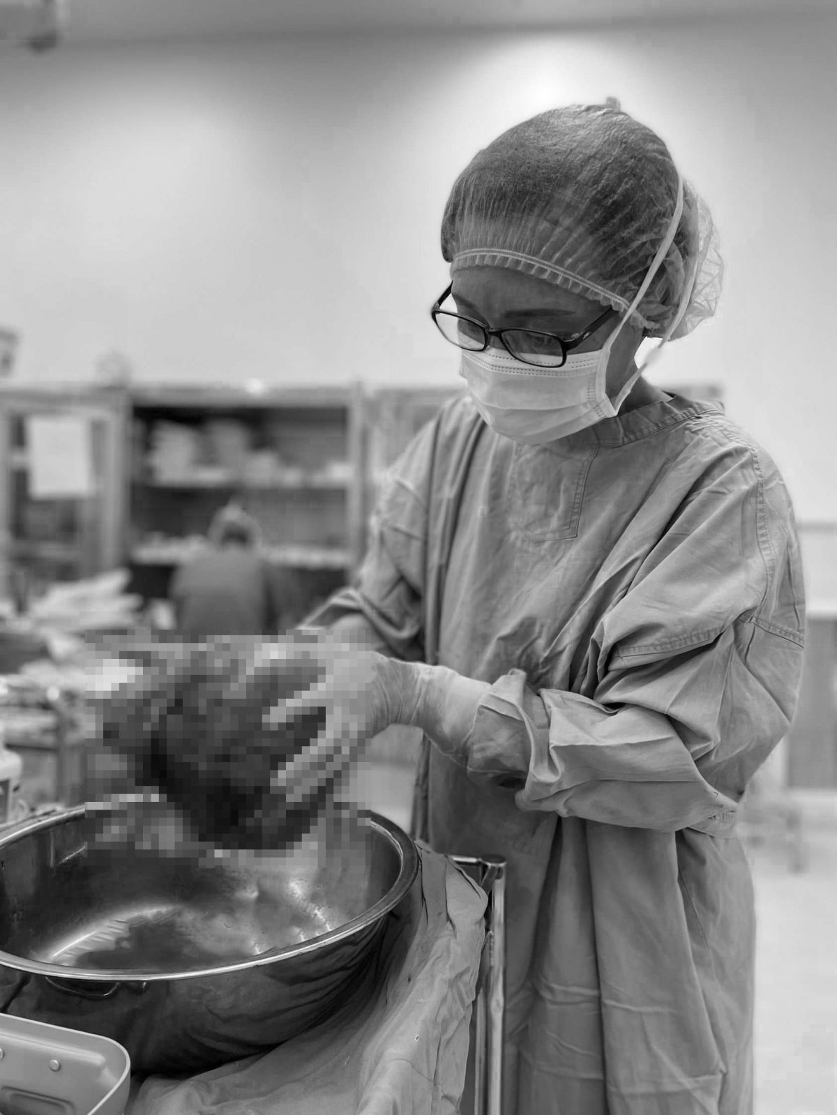 Kích thước khối u bằng một thai kỳ 7 tháng. Ảnh: Bệnh viện cung cấp