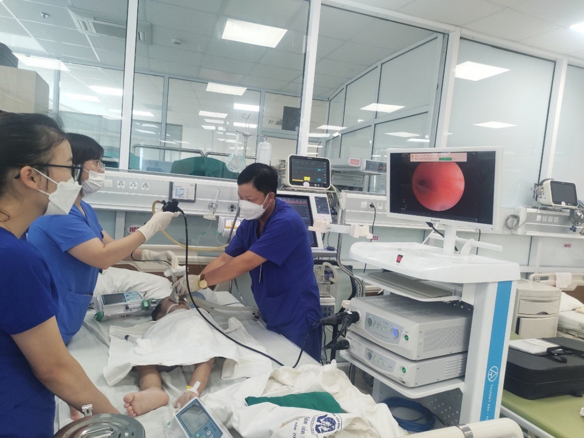 Các bác sĩ thực hiện kỹ thuật nội soi phế quản lấy dị vật trong đường thở của bệnh nhi