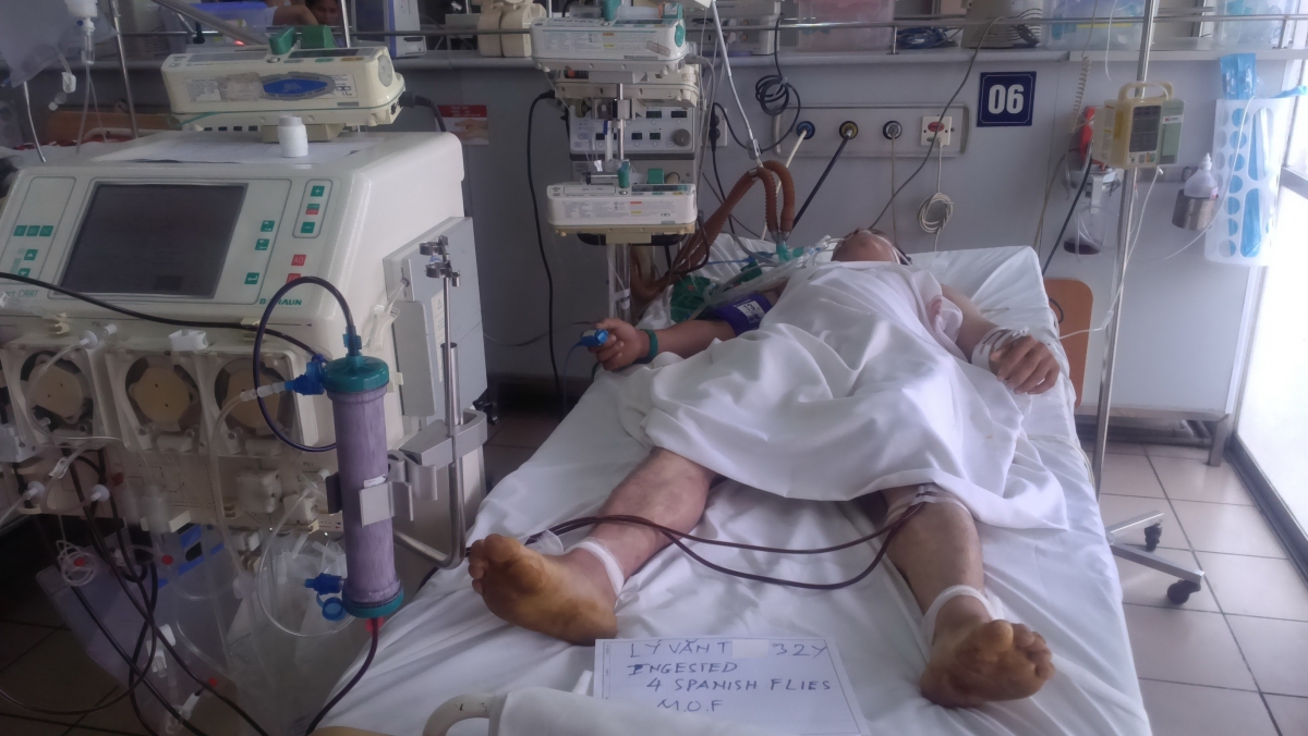 Một trườn hợp cấp cứu do ăn sâu ban miêu