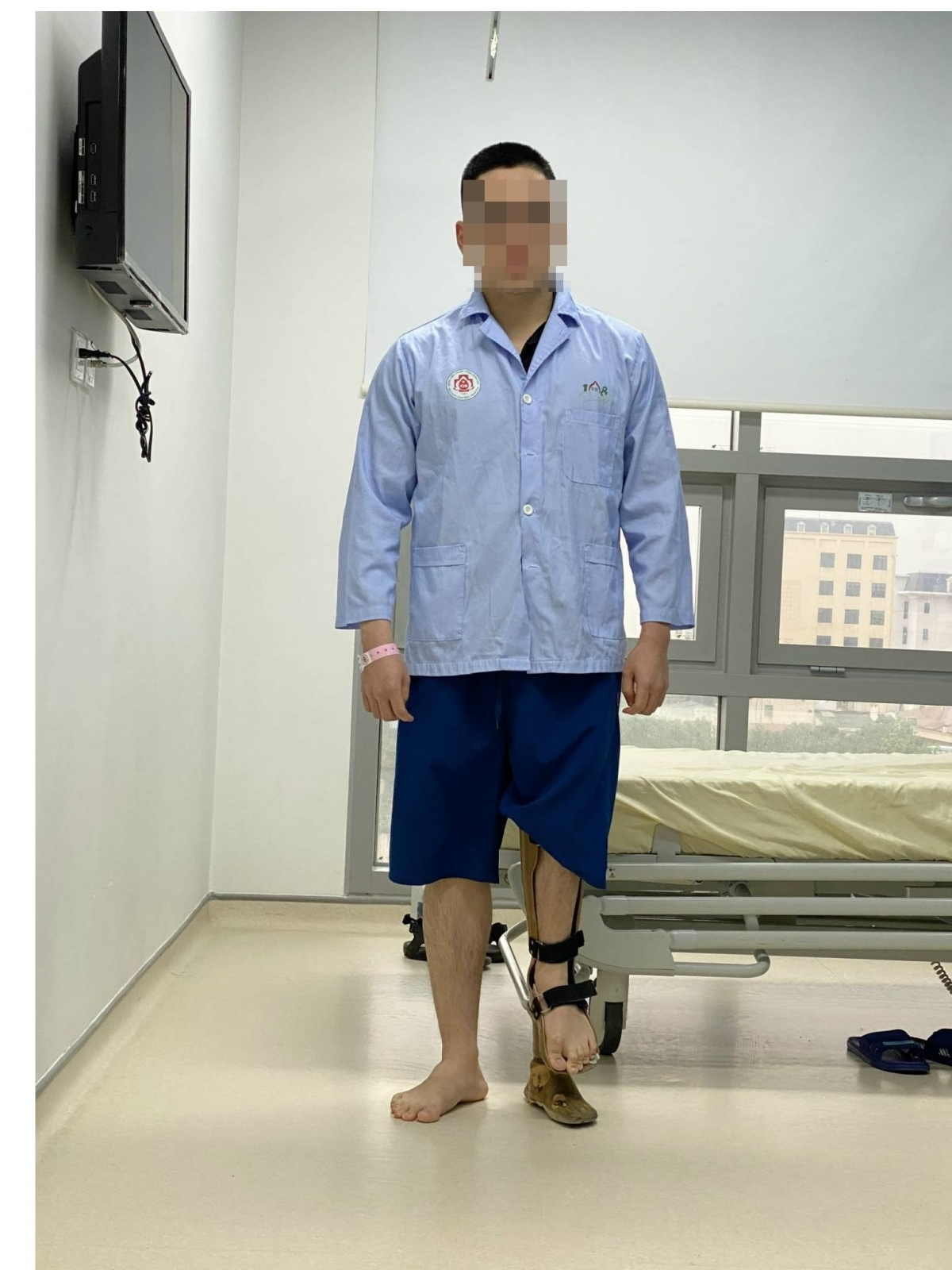 Bệnh nhân 23 tuổi trước khi phẫu thuật