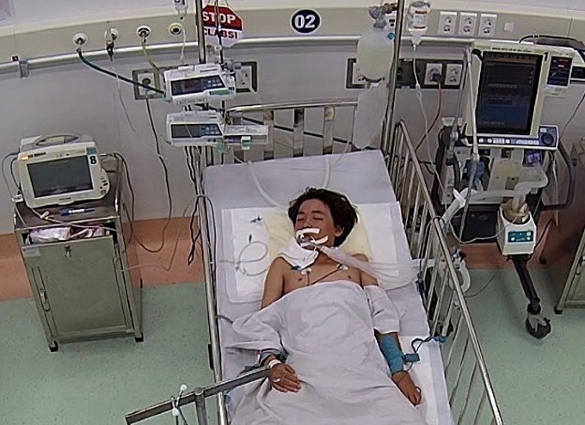 Bệnh nhi trong thời gian điều trị thở máy. Ảnh: Bệnh viện cung cấp