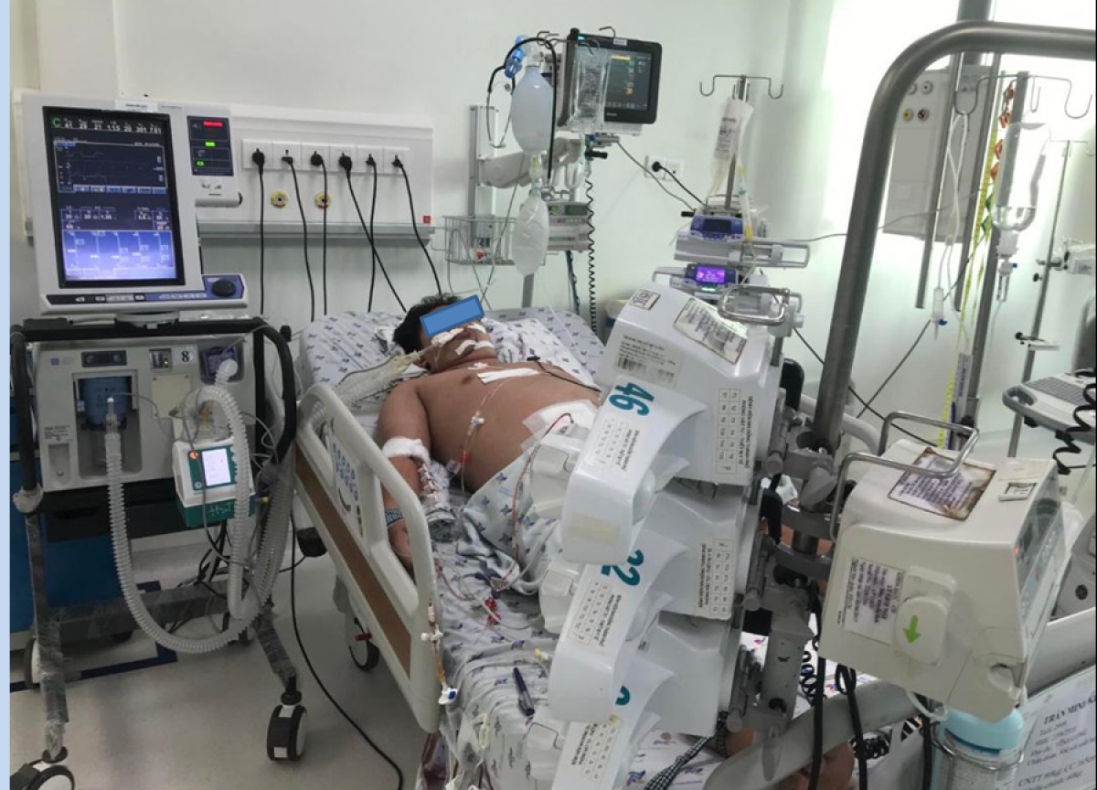 Một bệnh nhân bị sốc sốt xuất huyết dengue nặng được điều trị tại Bệnh viện Nhi đồng Thành phố.