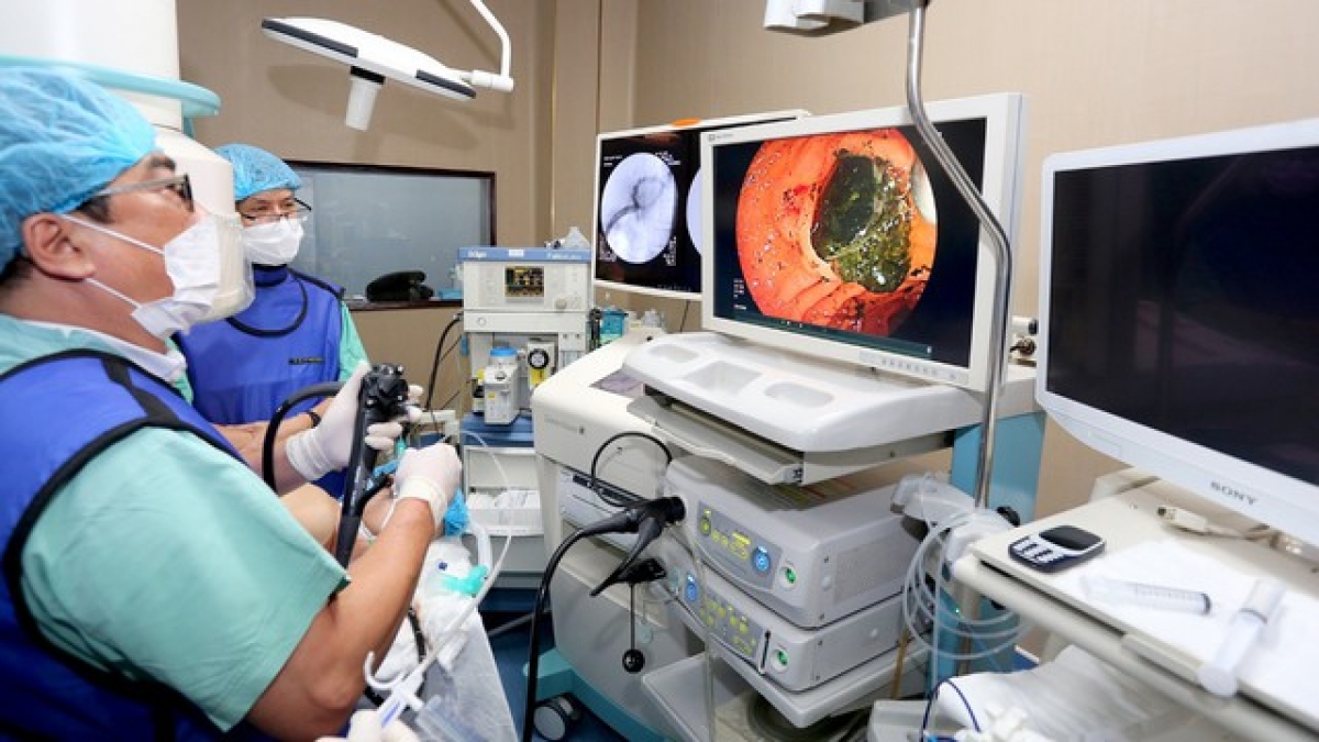 Các bác sĩ thực hiện tán sỏi trong gan cho bệnh nhân