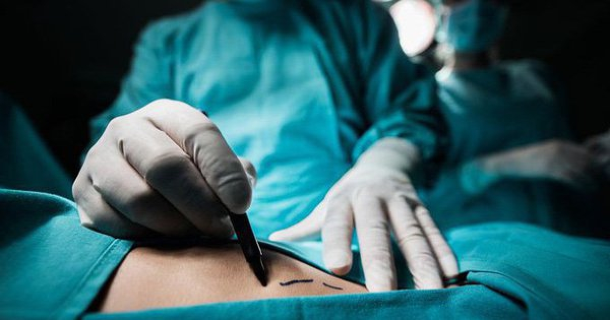Nhiều bệnh nhân bị tăng cân không kiểm soát sau phẫu thuật tuyến giáp