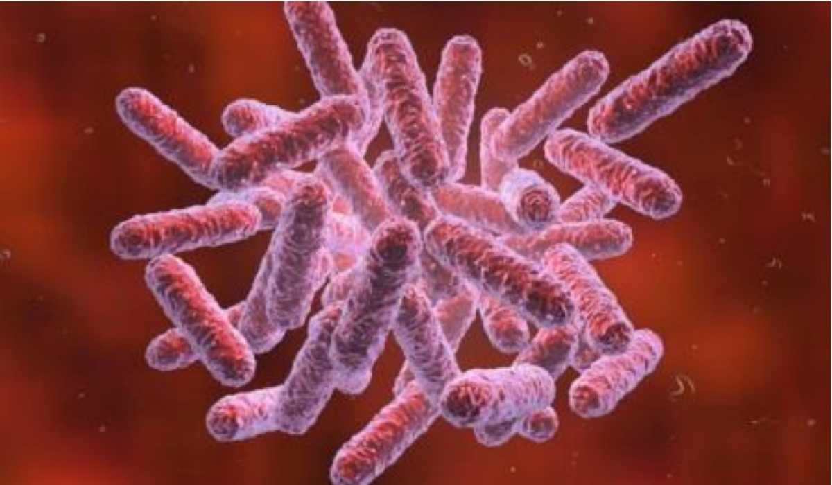 Whitmore là bệnh nguy hiểm do nhiễm vi khuẩn Burkholderia pseudomallei