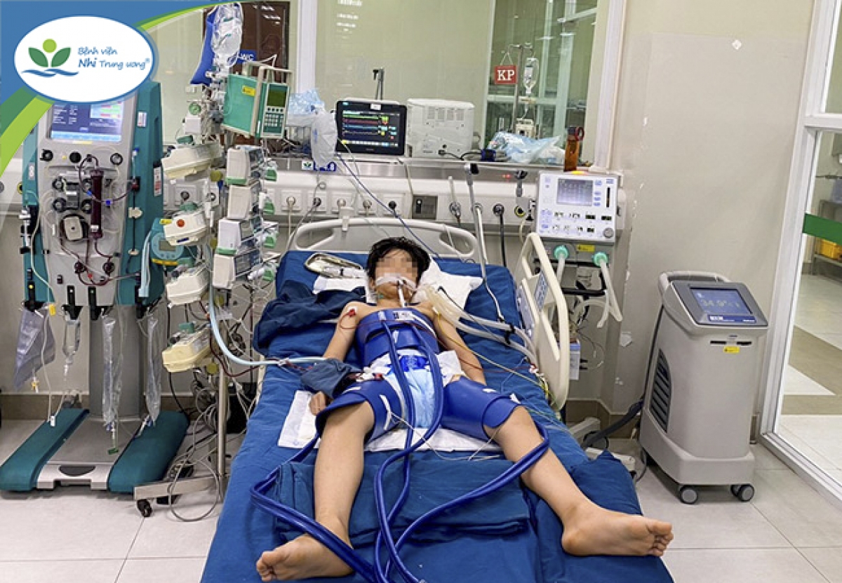 Bé M. được điều trị tích cực tránh các biến chứng thứ phát sau ngừng tuần hoàn tại BV Nhi TW