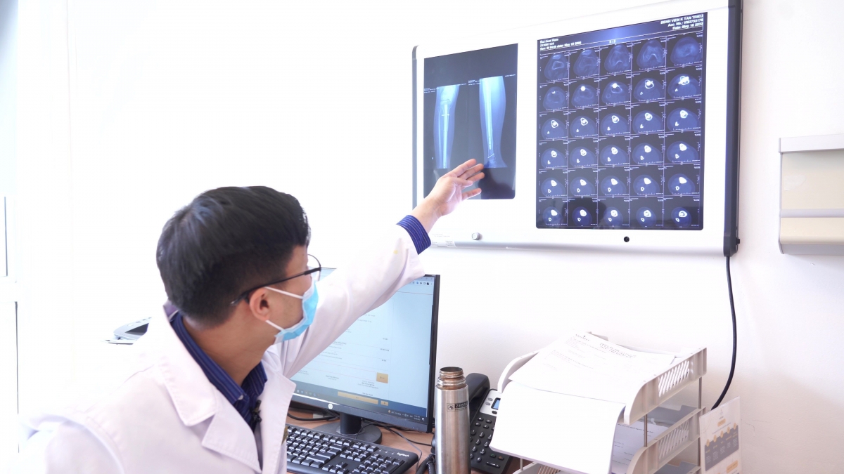 Hình ảnh X-quang của bệnh nhân cho thấy xương ghép đã liền và không còn tế bào ung thư