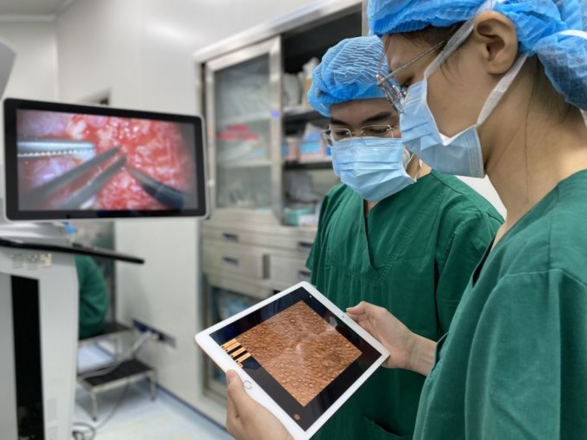 Kỹ thuật vi phẫu micro-TESE được xem là một trong những tiến bộ vượt bậc trong điều trị vô sinh nam, là "cứu cánh" giúp nam giới vô sinh "truy tìm" tinh trùng, mở ra rất nhiều hy vọng cho hàng ngàn nam giới vô tinh được làm cha, hạnh phúc đón con yêu của chính mình.