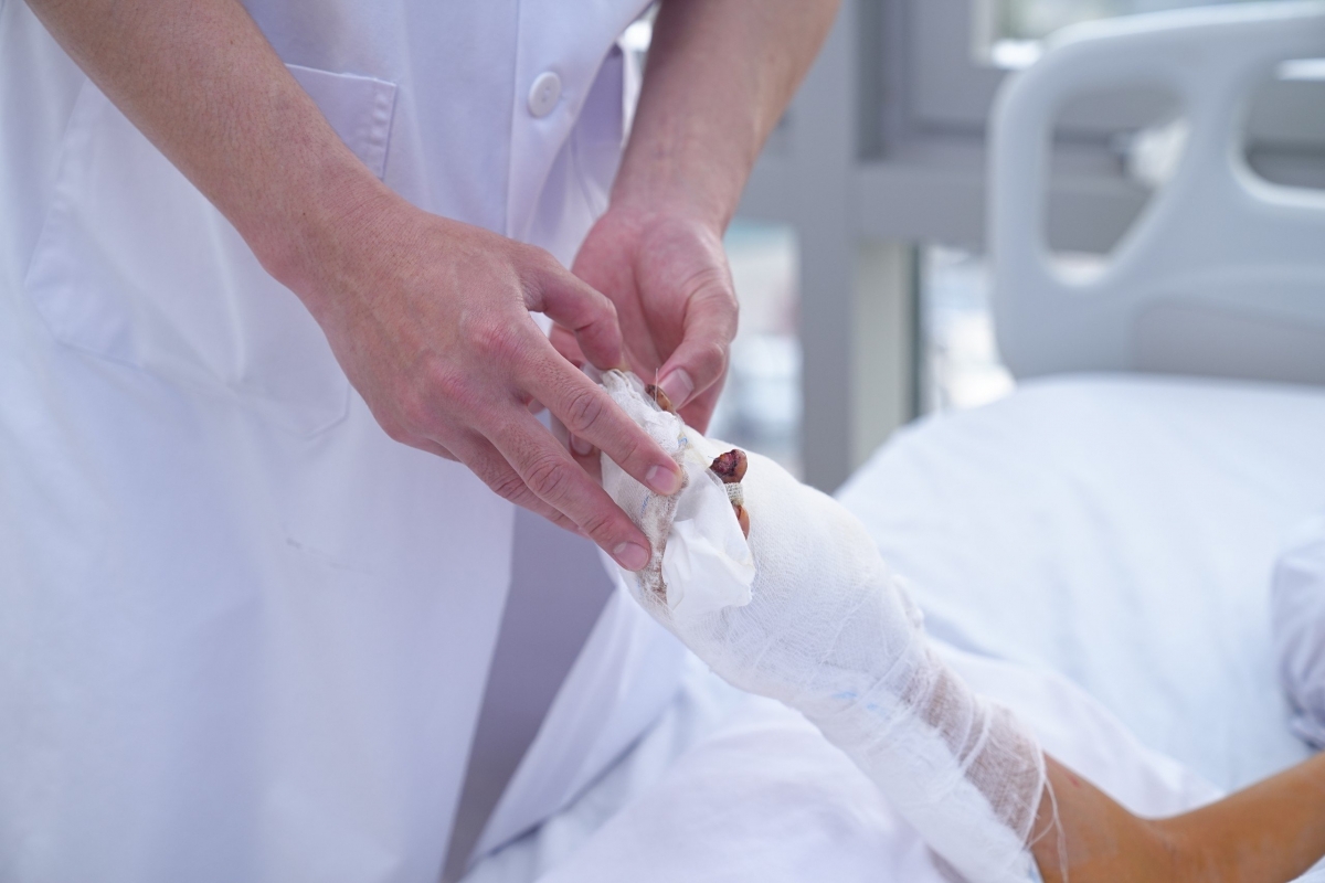 Bàn tay dập nát của nam sinh sau khi được bác sĩ băng bó. Ảnh BV cung cấp
