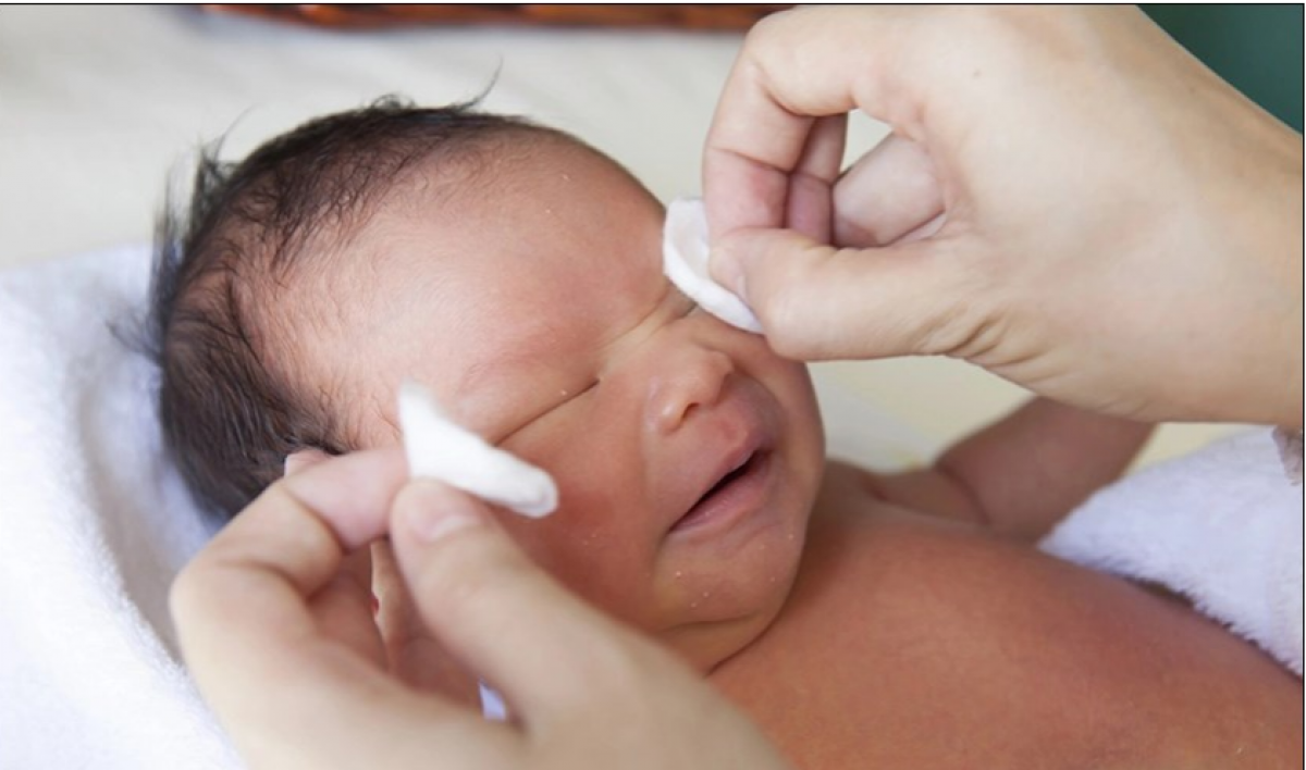 Thường xuyên mát xa mắt cho bé sẽ giúp cho bệnh khỏi nhanh