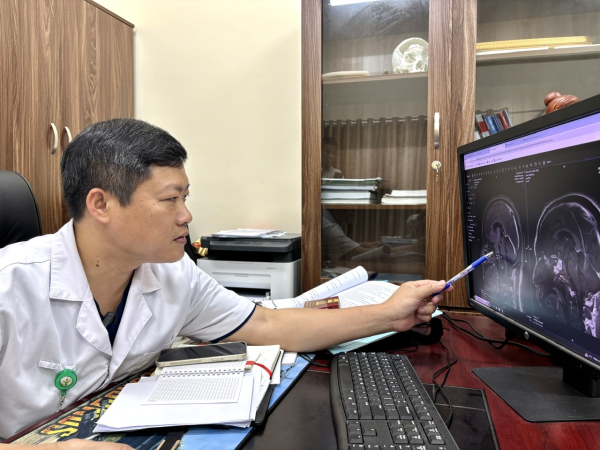 TS.BS Nguyễn Duy Tuyển, Trưởng khoa Phẫu thuật Thần kinh 2 xem phim chụp của bệnh nhân trước khi phẫu thuật. (Ảnh: Bệnh viện cung cấp)