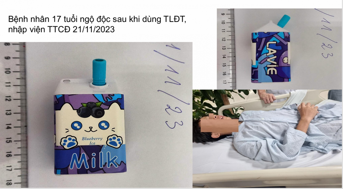 Tình hình bệnh nhân diễn biến nhanh, phức tạp do ngộ độc hóa chất trong thuốc lá điện tử (Nguồn: Bệnh viện Bạch Mai)