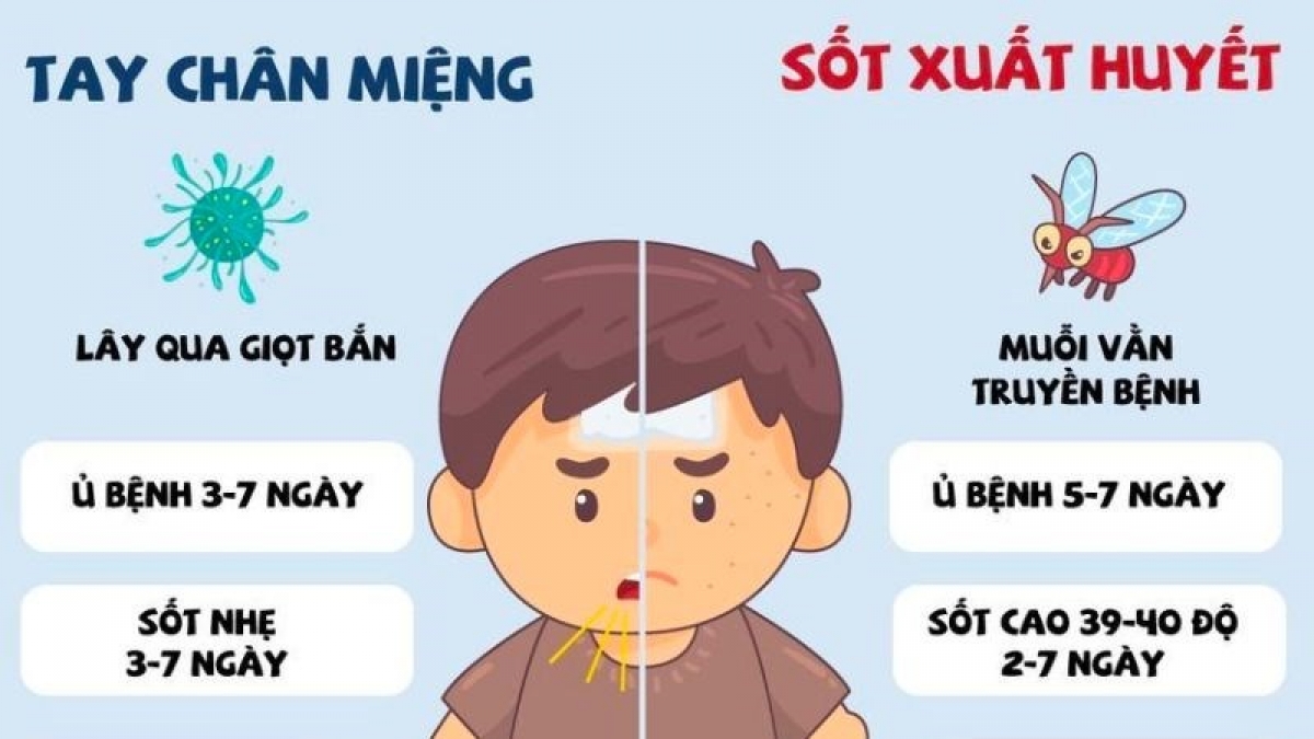 Phân biệt bệnh tay chân miệng và sốt xuất huyết đầu tiên qua triệu chứng sốt (Ảnh: Internet)